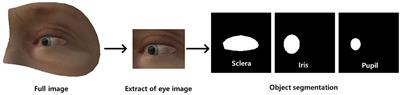 Feasibility of video-based real-time nystagmus tracking: a lightweight deep learning model approach using ocular object segmentation